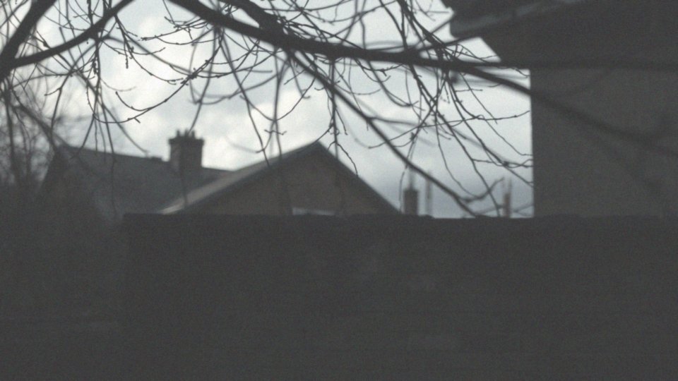 Zatkane tętnice szyjne objawy – jak je rozpoznać i leczyć?